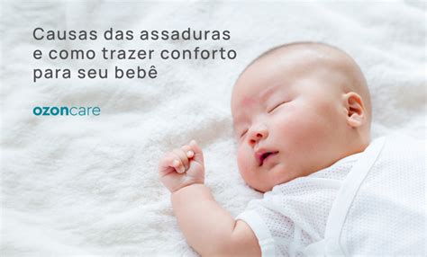 Como É Assadura Em Bebe - Causas das assaduras e como trazer conforto para seu bebê - Philozon