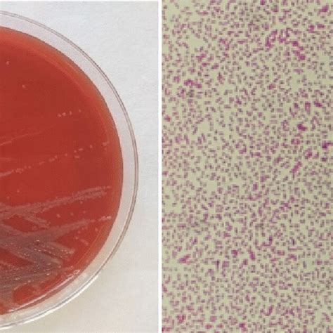 Sphingobacterium Mizutaii Colonies On Blood Agar And Gram Stain Photo