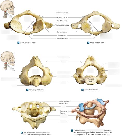 Atlas and Axis Diagram | Quizlet