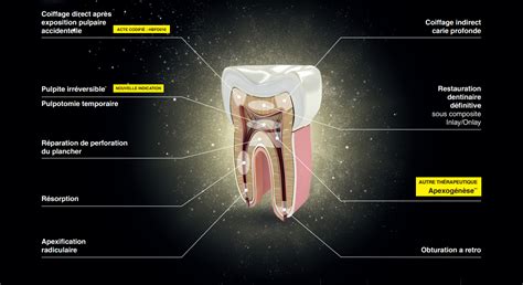 Biodentine un matériau incontournable disponible à Paris La Défense