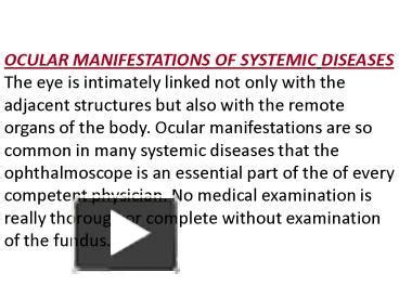 Ppt Ocular Manifestations Of Systemic Diseases The Eye Is Intimately