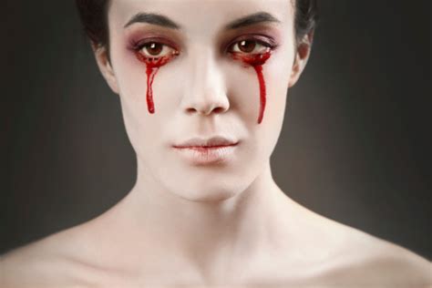 MYTH OR FACT: Can people really cry tears of blood? - Health Beat