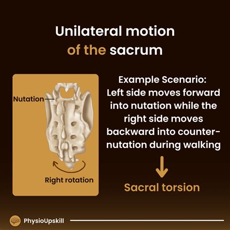 episode kinesiology  sacroiliac joint physioupskill