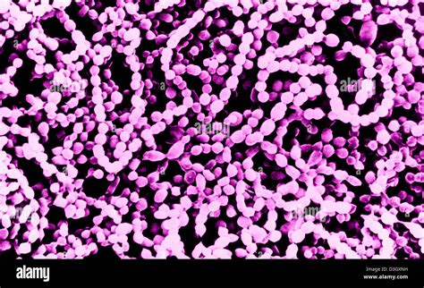 Streptococcus Pyogenes Morphology