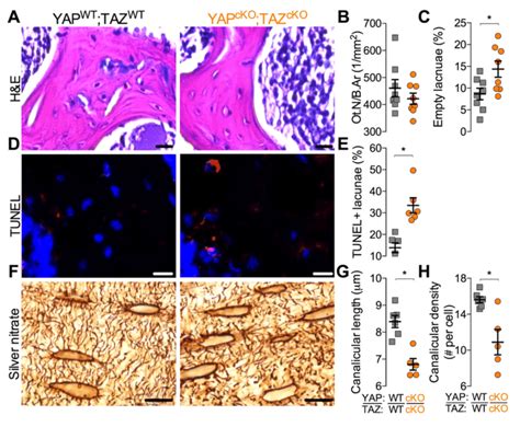 Yap Taz Ablation From Dmp Expressing Cells Increased Osteocyte