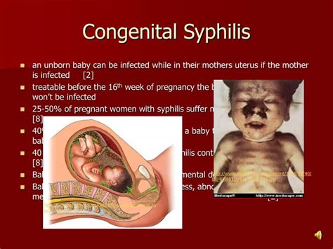 Ppt Syphilis Powerpoint Presentation Id