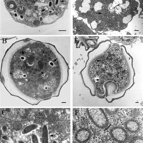 Phase Contrast Micrographs Of Endosymbionts Of Acanthamoeba Stained Download Scientific Diagram