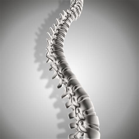 3D-Printed vs. Traditional Implants for Spinal Fusion - All Peers