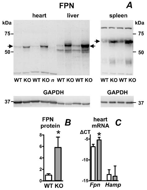 Ijms Free Full Text Heart Ferroportin Protein Content Is Regulated