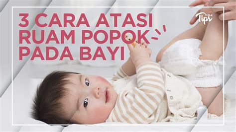 Cara Ampuh Mengatasi Ruam Popok Pada Bayi Youtube