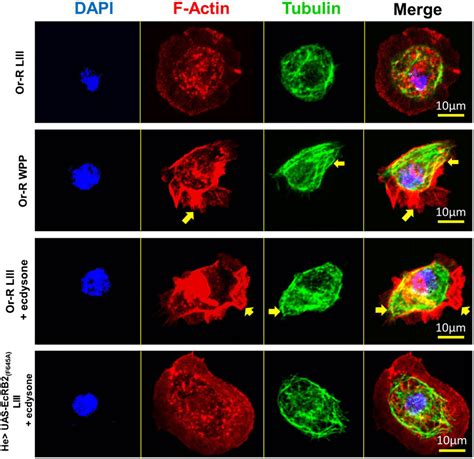 Cytoskeletal Analysis Showing Actin And Microtubule Distribution In