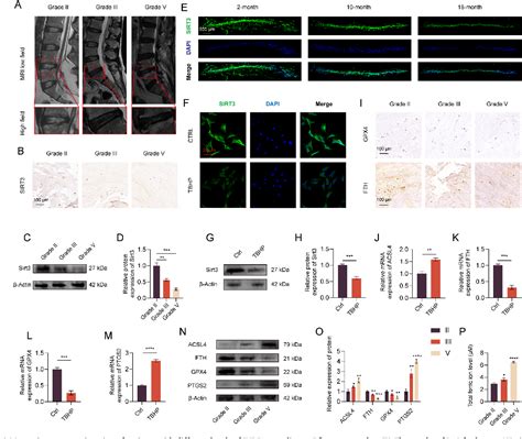 Figure 1 From The Deubiquitinase Usp11 Ameliorates Intervertebral Disc