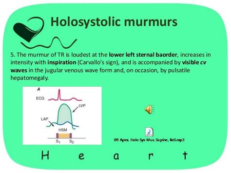 heart murmur (heart extra sounds)