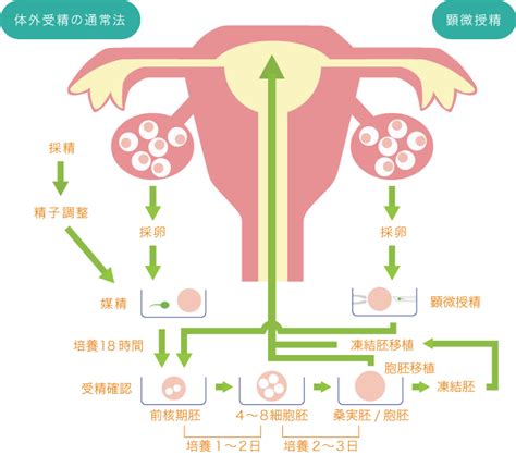 【排卵から移植までのプロセス・スケジュール】体外受精 不妊治療 京都で不妊治療・人工受精・産婦人科なら醍醐渡辺クリニックへ