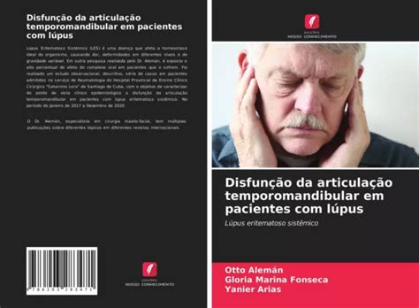 Disfun O Da Articula O Temporomandibular Em Pacientes L Pus