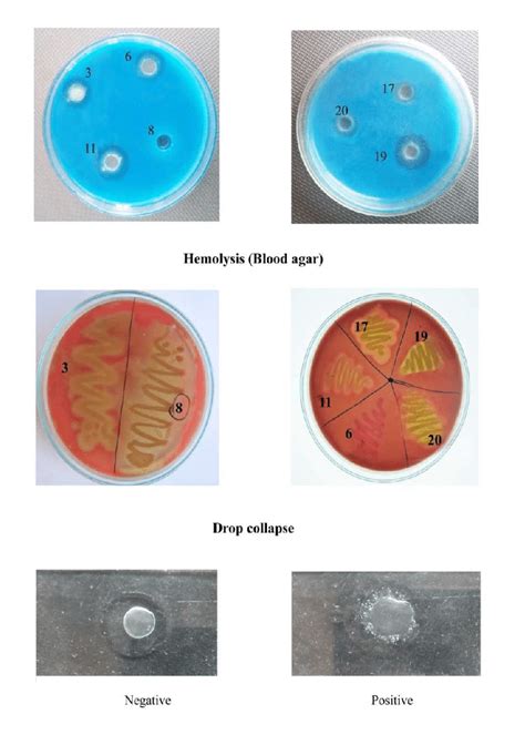 Screening of biosurfactant producing bacteria | Download Scientific Diagram