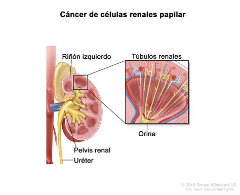 S Ndromes Hereditarios De C Ncer De Ri N Vicare Gu