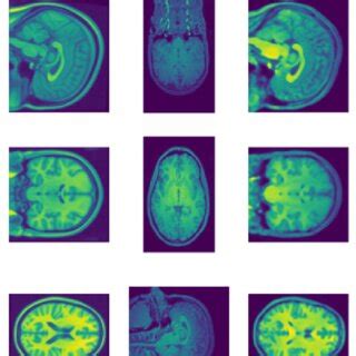 Each plane of; (a) Reference MRI, (b) Original MRI, (c) Registered MRI ...