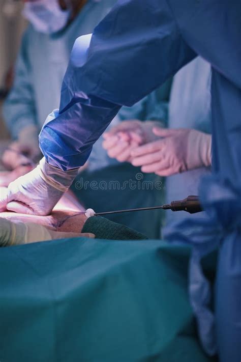 Definition Liposuction Stock Photos Free Royalty Free Stock Photos