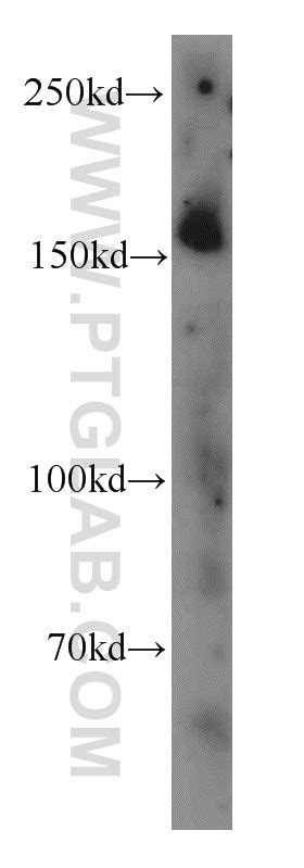 KIF15 Fusion Protein Ag33897 Proteintech