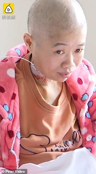 Chinese Mother Of Two Whose Belly Ballooned By Pounds Due To Ovarian