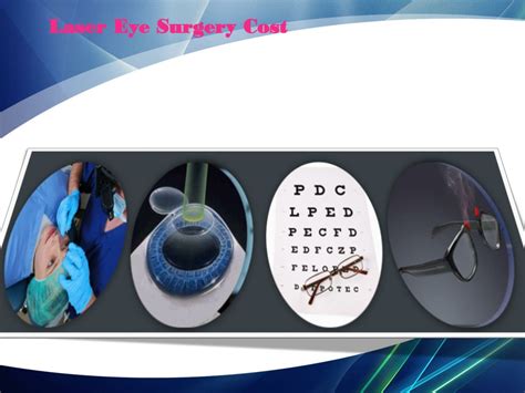 PPT - Laser Eye Surgery PowerPoint Presentation, free download - ID:1272032
