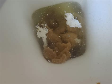 White mucus? : r/poop