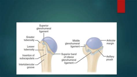 Recurrent Shoulder Dislocation And Management PPT