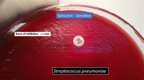 Optochin Susceptibility test :Principle, procedure, result and interpretation