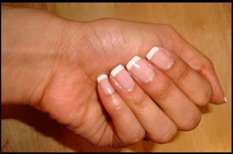 10 Home Remedies For Peeling Cuticles Complete Health News