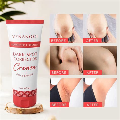 Pulchra Dark Spot Corrector Cream Dark Spot Remover For Body Underarm Neck Armpit Knees Elbows