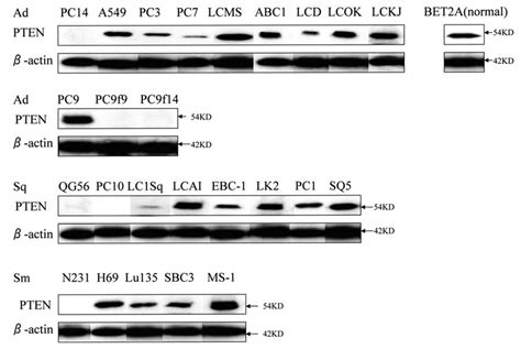 Western Blot Analysis Of Pten Protein Expression The Expression Levels