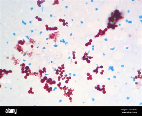 Mycobacterium marinum bacteria, light micrograph. Mycobacterium marinum is an opportunistic ...