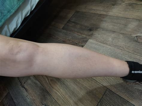 Close Up Of Milf S Hairy Pussy Pics Xhamster