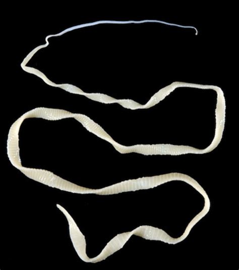 What Does Tapeworms Look Like In Human - Infoupdate.org