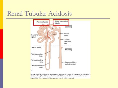 PPT - Renal Tubular Acidosis PowerPoint Presentation, free download ...