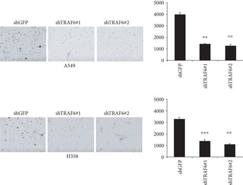 TRAF6 Was Overexpressed In NSCLC And Mediates Cell Proliferation A