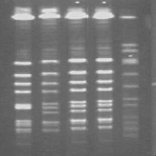 Pfge Pattern Of The Isolate Ro And Ro After Smai Digestion