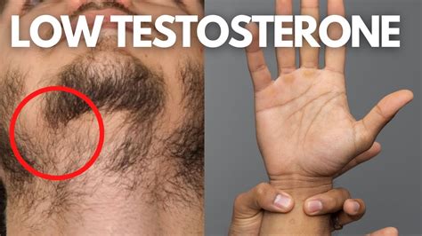 ¡5 Señales De Que Sus Niveles De Testosterona Están Bajando Estan Más