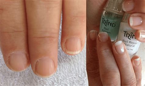 Some Simple Tips And Ways To Stop Nails Splitting Nail Repair Miracle