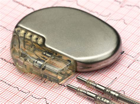 Heart Pacemaker: Purpose, Procedure, & Risks