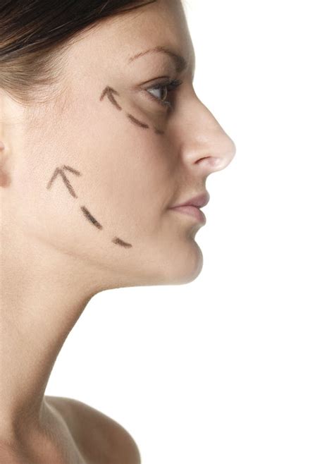 Macs Facelift Advanced Dermatology