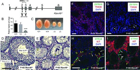 Adult Rbm Testes Were Dramatically Reduced In Size And Contained