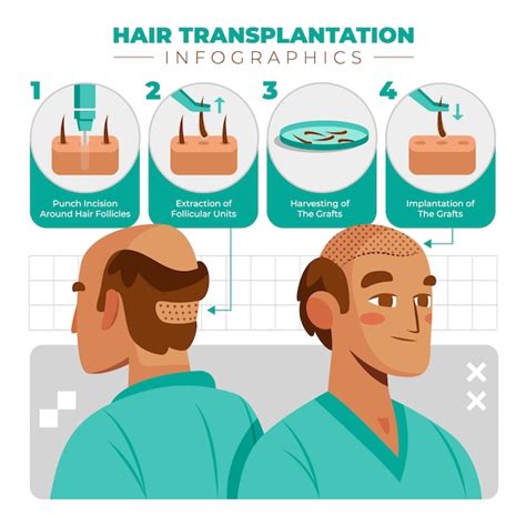 Premium Vector Hair Transplant Flat Cartoon Infographics