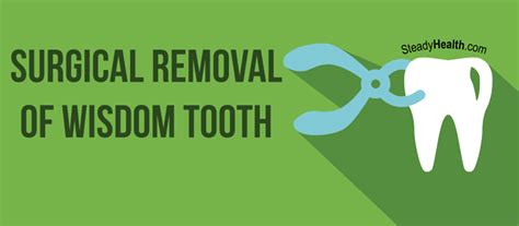 Surgical Removal Of Wisdom Tooth: What To Expect And Aftercare Tips ...