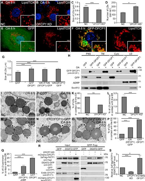 Figure 4 From The Er Localized Protein Dfcp1 Modulates Er Lipid Droplet