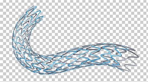 Stenting Drug-eluting Stent Coronary Stent Bioresorbable Stent Bare ...