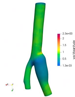 Bifurcation aorta: WSS at different stages of cardiac cycle | Download ...