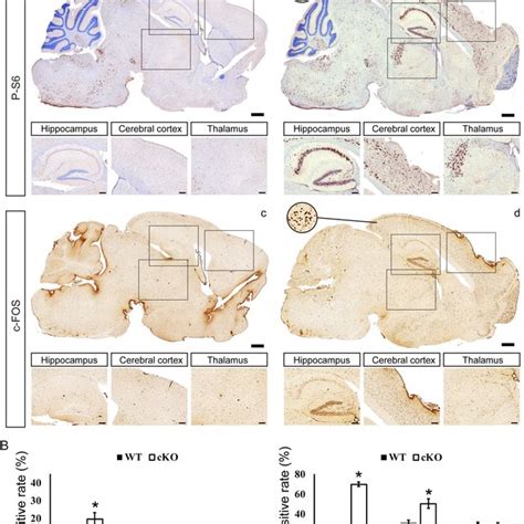 Hyperactivation Of MTOR Induced Neural Excitation In Tsc2 Mitf M CKO