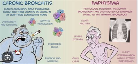 MS - COPD and Pneumonia Flashcards | Quizlet